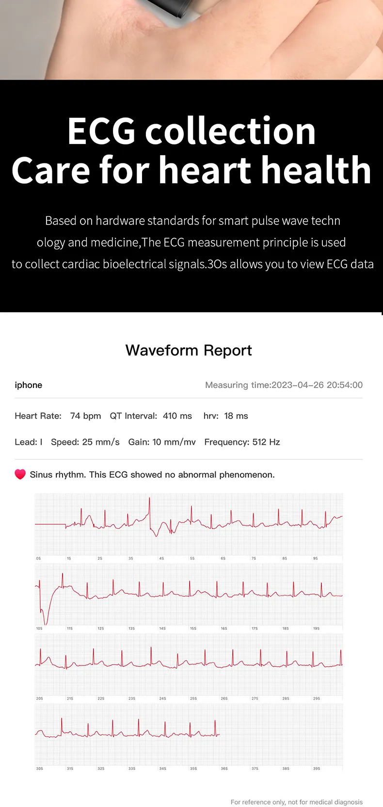 ECG Health Smartwatch ET440