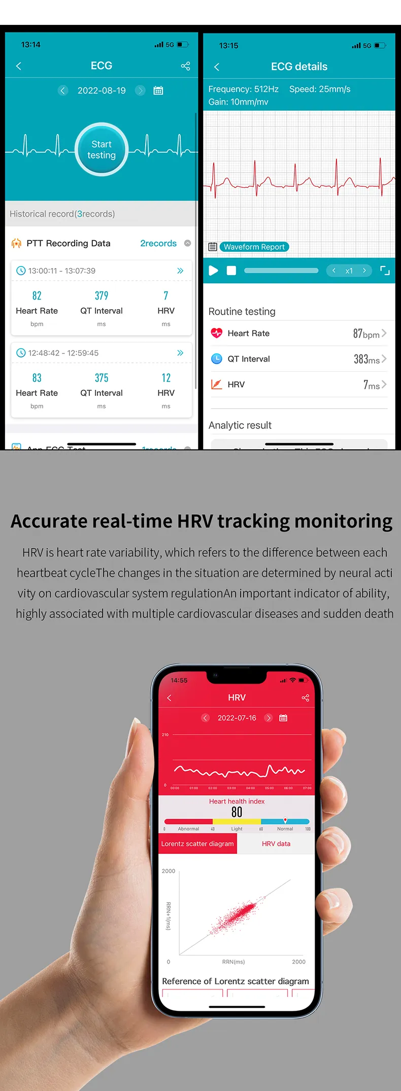 ECG Health Smartwatch ET440