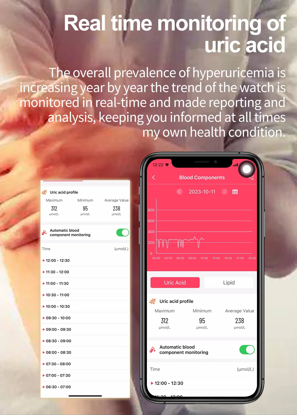ECG Health Smartwatch ET470