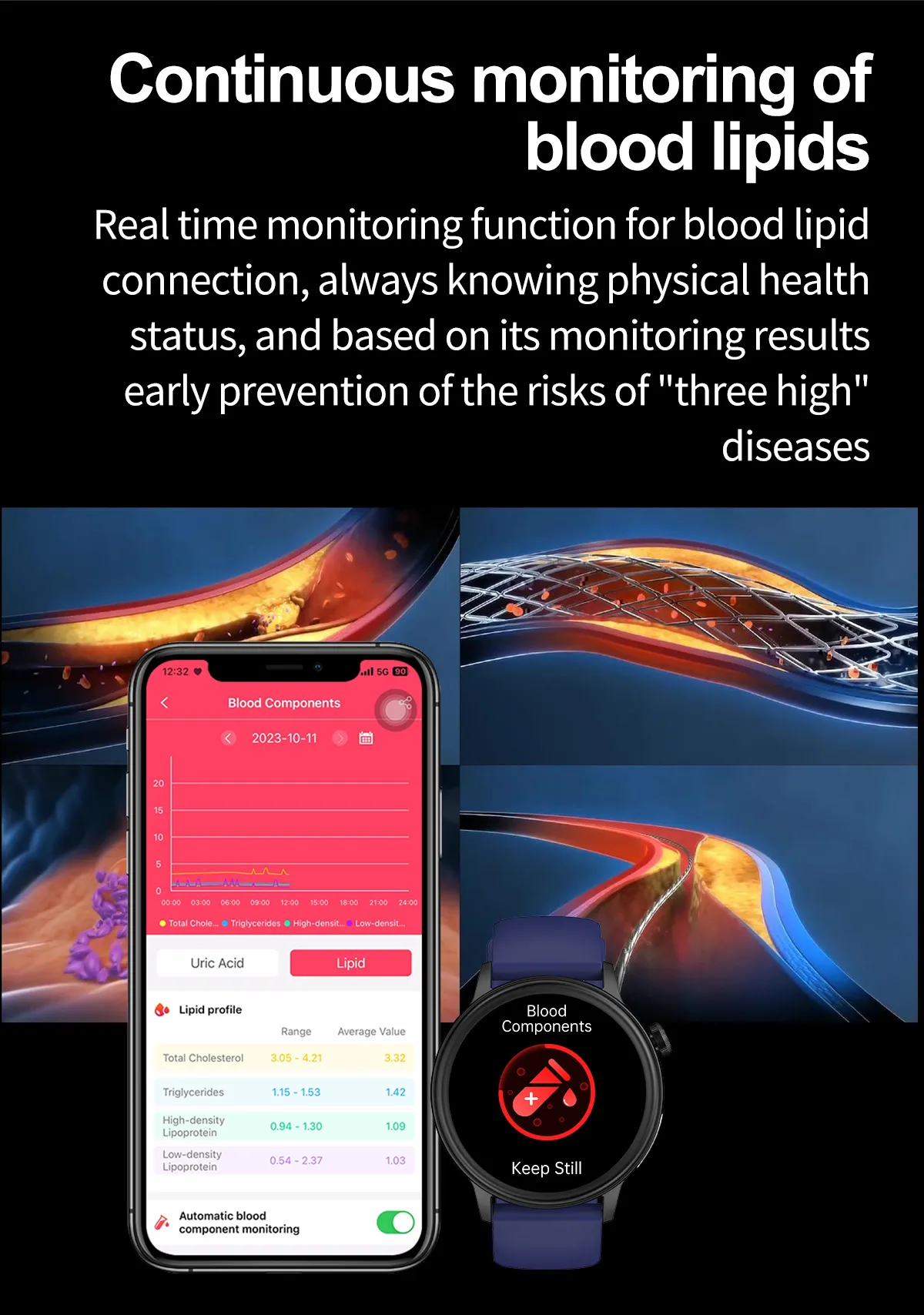 ECG Health Smartwatch ET470