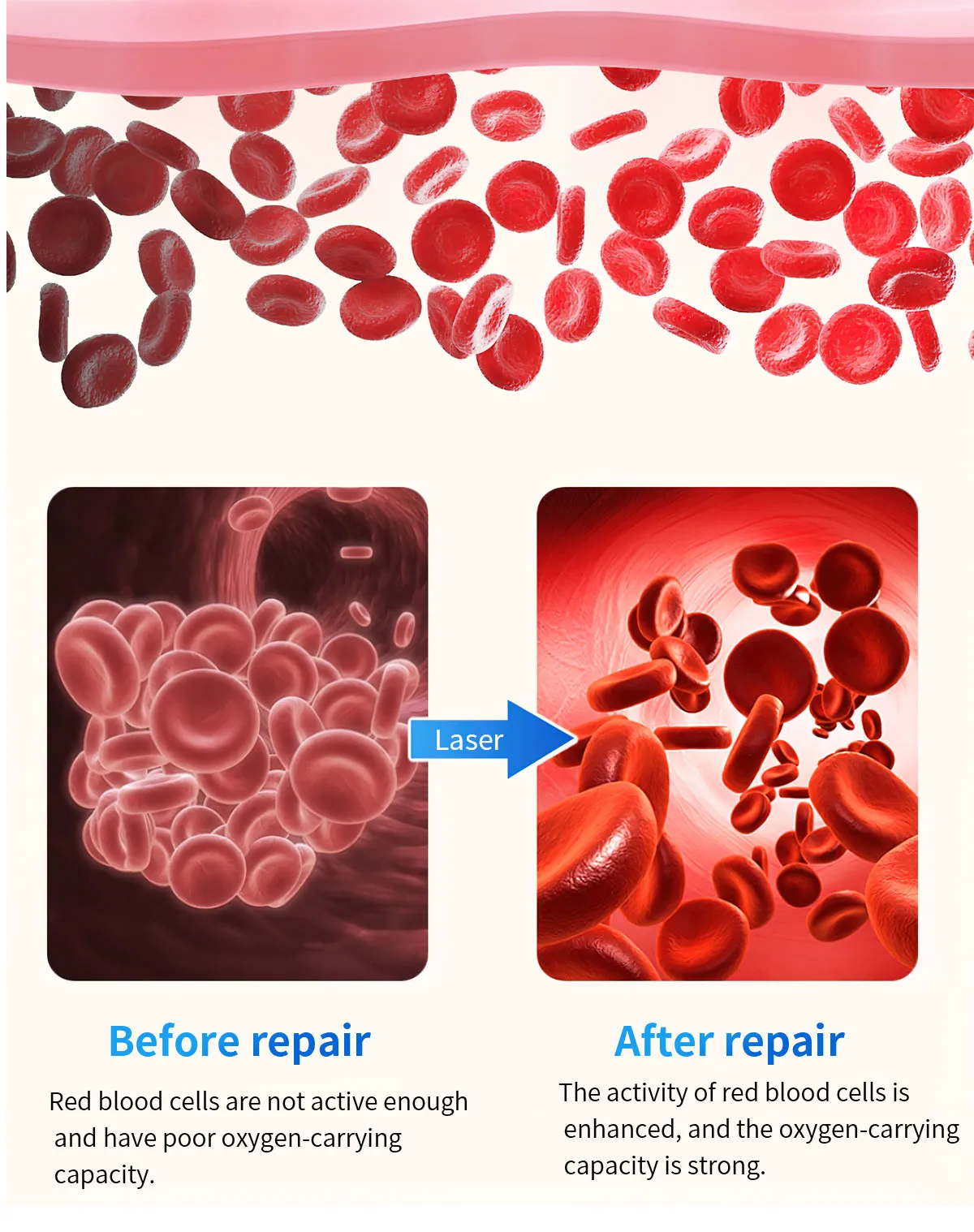 ECG Health Smartwatch F100