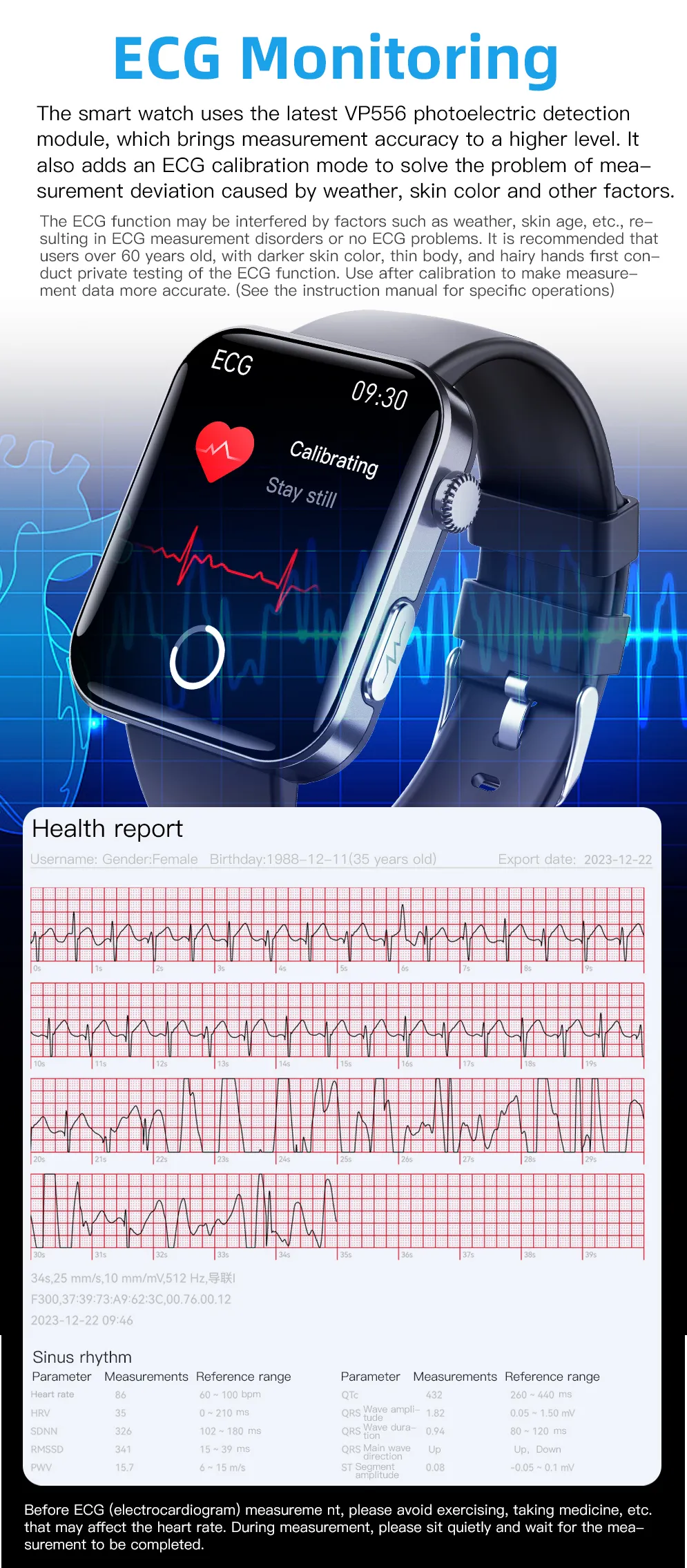 ECG Health Smartwatch F300