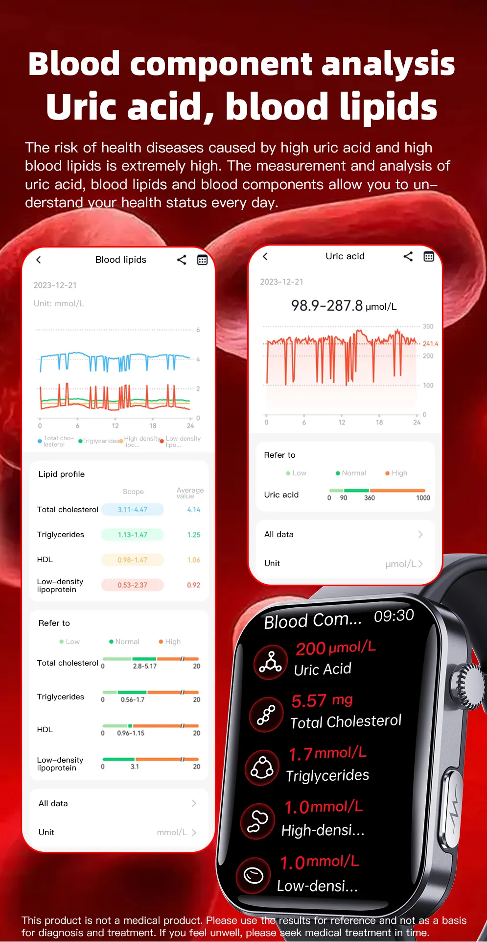 ECG Health Smartwatch F300