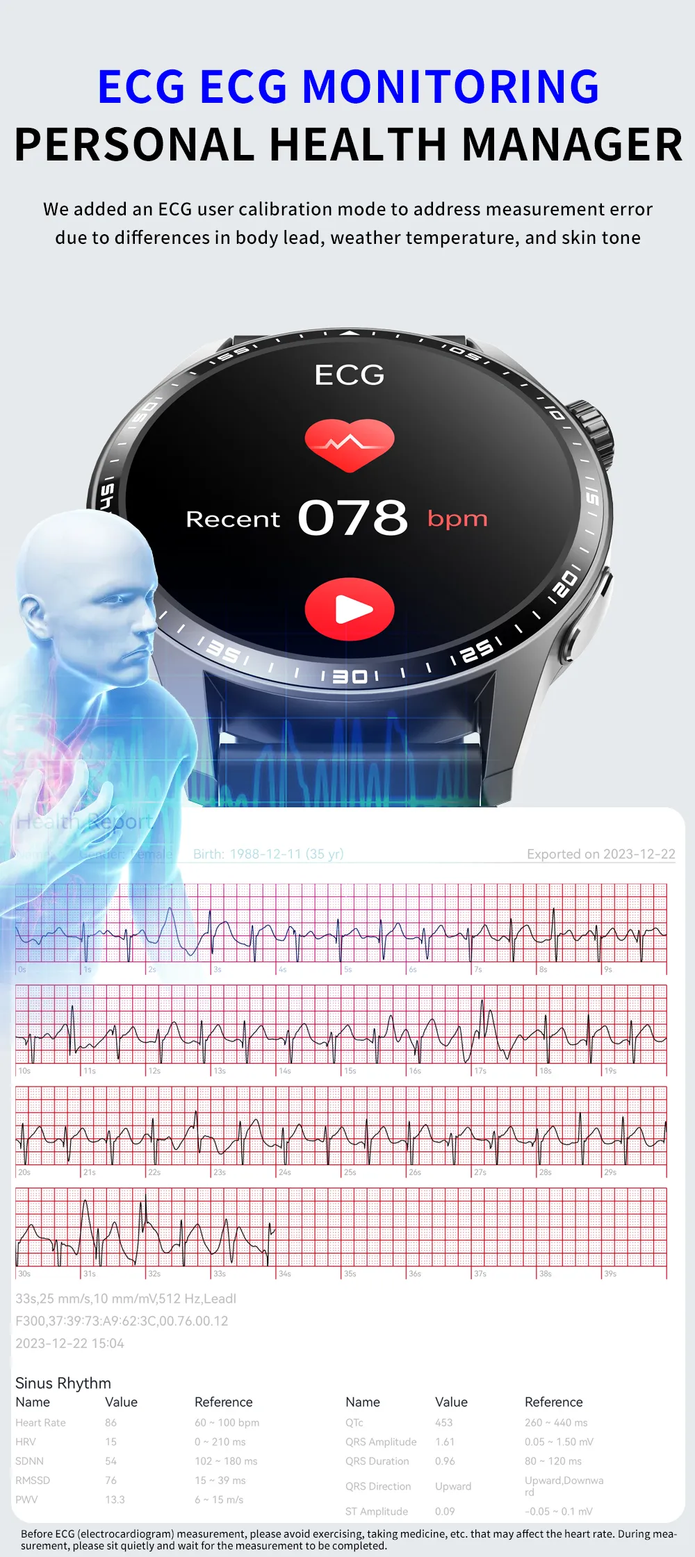 ECG Health Smartwatch F400