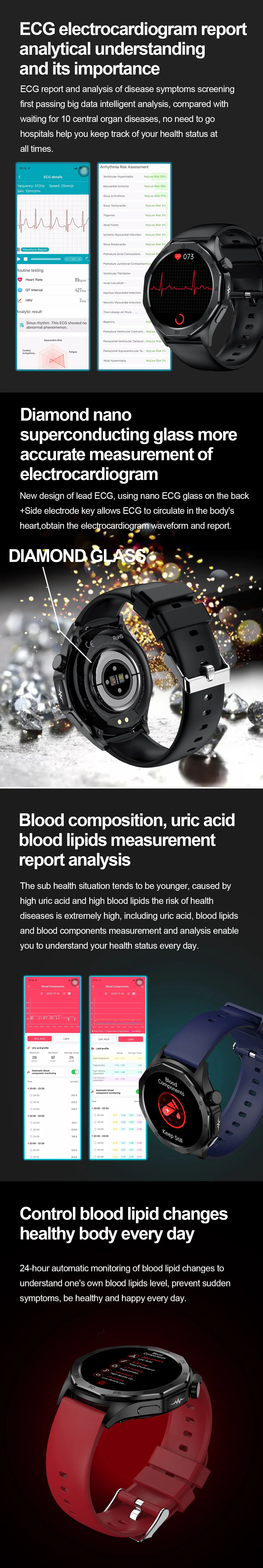 ECG Health Smartwatch ET480