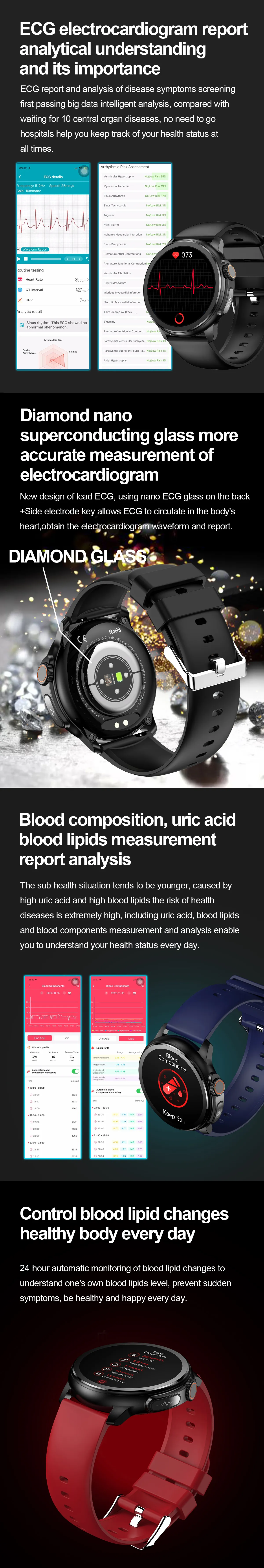 ECG Health Smartwatch ET481